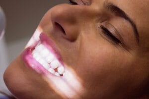 Leia mais sobre o artigo Quais são as formas de branquear os dentes?