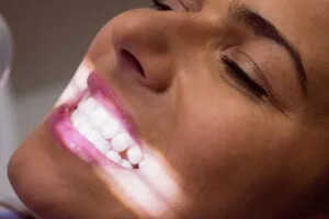 Leia mais sobre o artigo Quais são as formas de branquear os dentes?