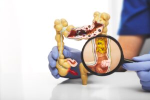 Leia mais sobre o artigo A importância da saúde intestinal para o bem-estar geral